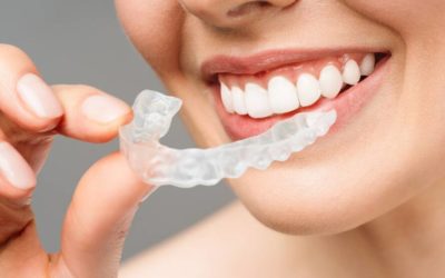 Les 3 Solutions pour Remplacer Efficacement une Dent Manquante