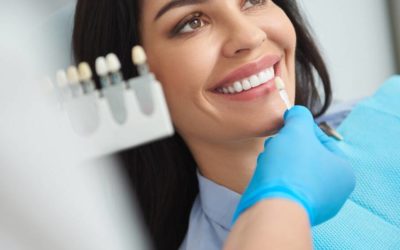 L&rsquo;implant Dentaire : Définition, Pose et Avantages