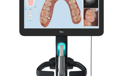 Empreinte optique et scanner 3D : dites adieu à la pâte dentaire !